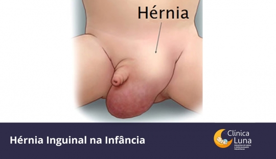 Hérnia Inguinal na Infância